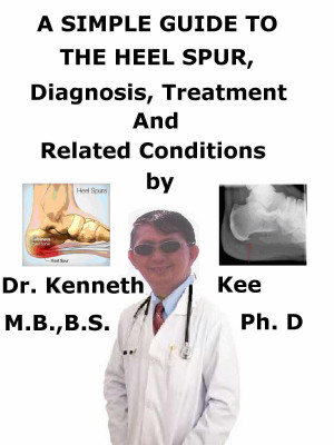 A Simple Guide to Postural Tachycardia Syndrome, Diagnosis, Treatment and  Related Conditions by Kenneth Kee, eBook