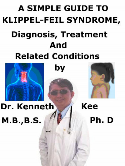 Smashwords – A Simple Guide To Klippel-Feil Syndrome, Diagnosis ...