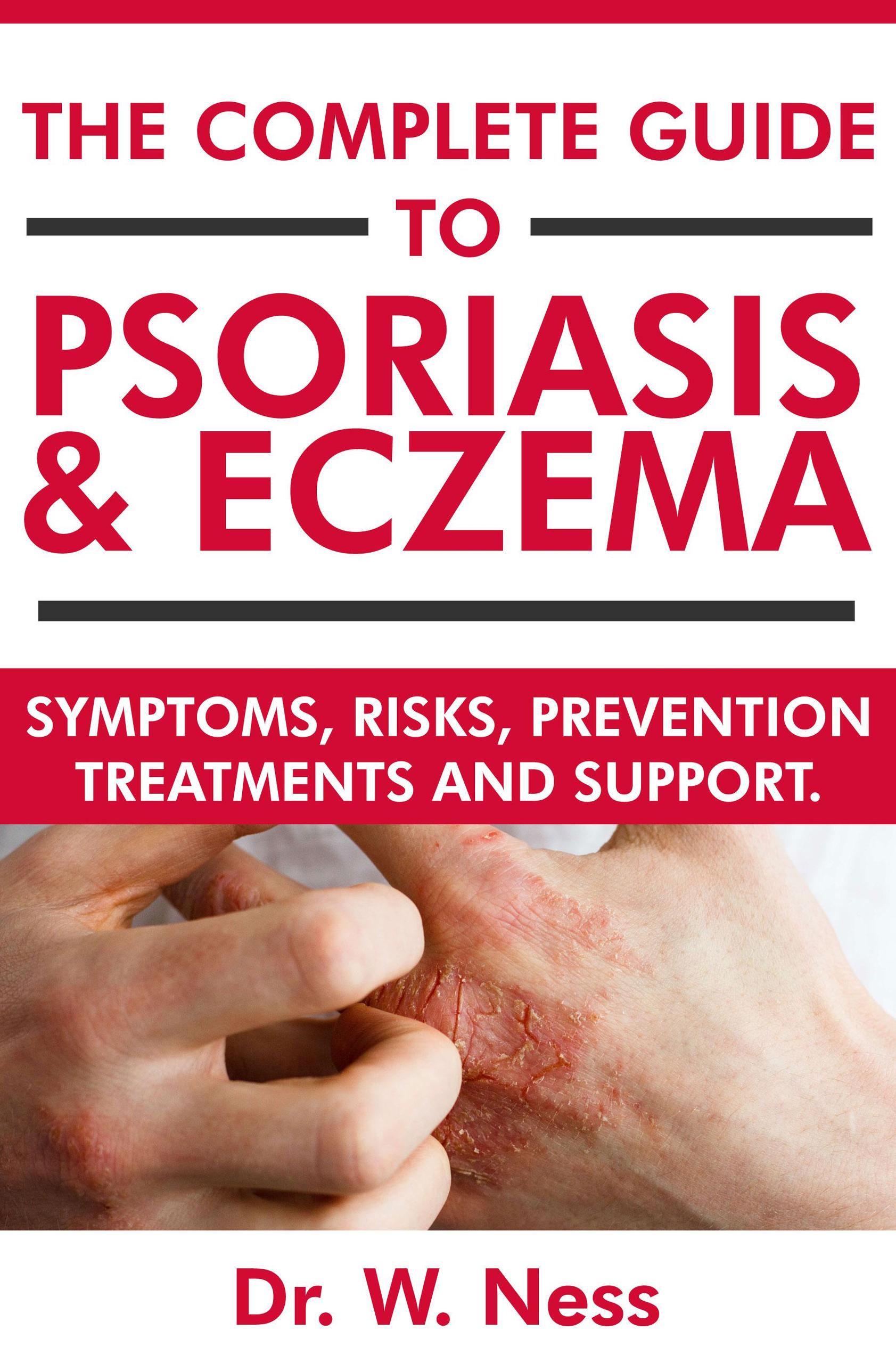 Smashwords – The Complete Guide To Psoriasis & Eczema: Symptoms, Risks ...