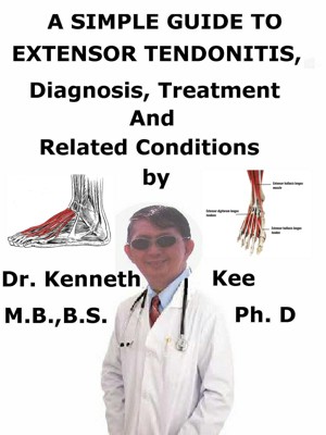 A Simple Guide to Postural Tachycardia Syndrome, Diagnosis