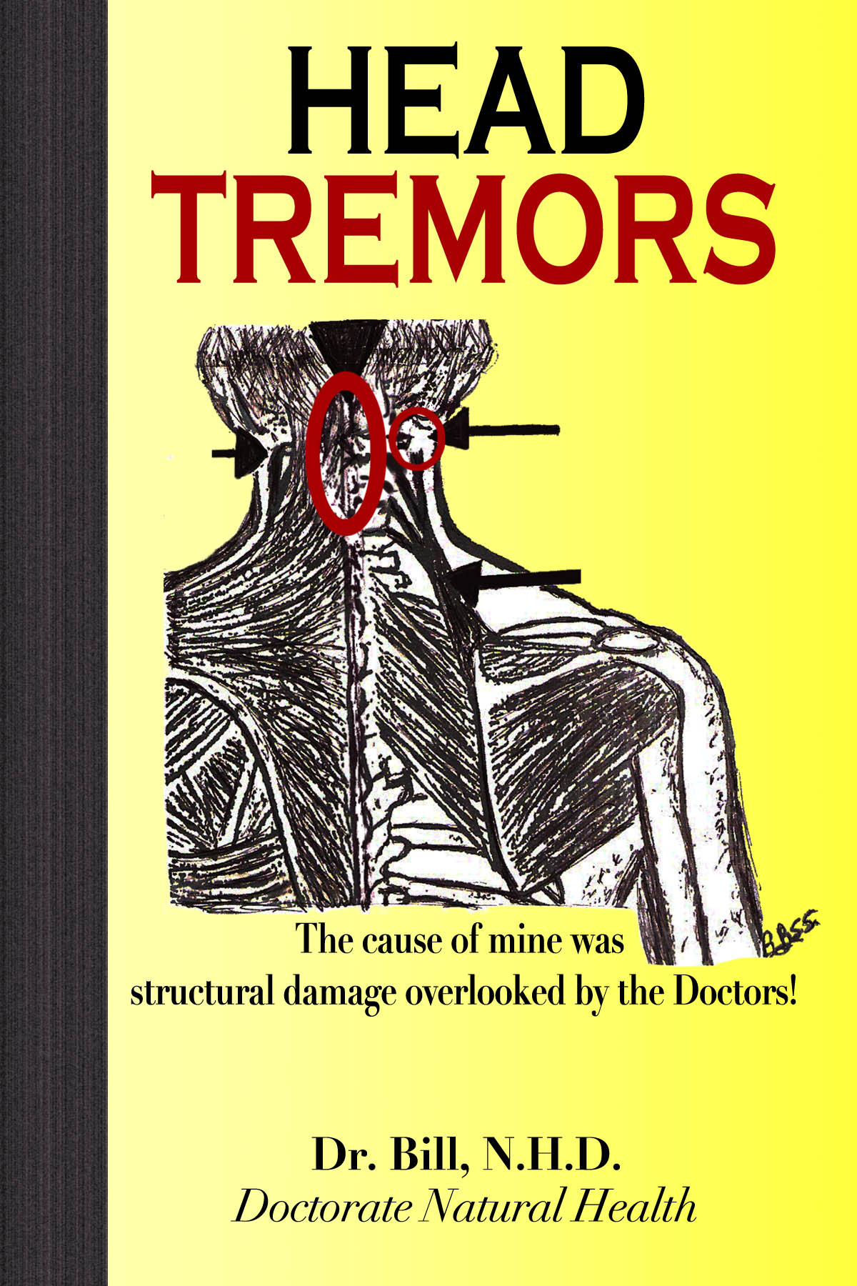 Smashwords HEAD TREMORS The Cause Of Mine Overlooked By Doctors A Book By Dr Bill N H D 